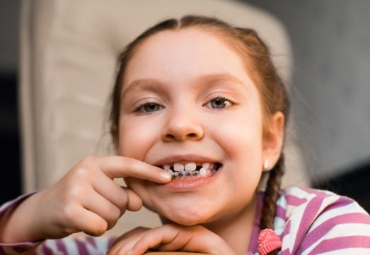 Child with phase one pediatric orthodontics