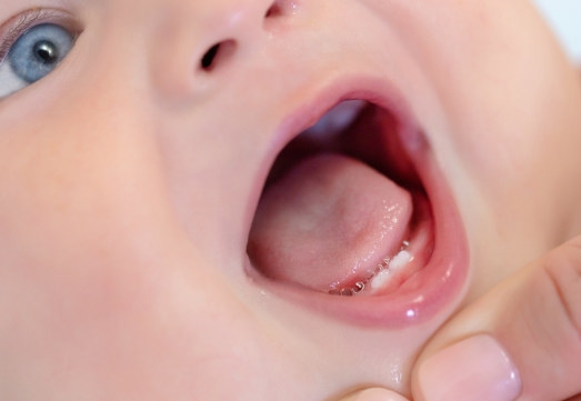 Pediatric dentist examining teething baby
