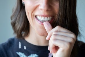 Nose to chin view of a woman with brown hair removing her Invisalign with her thumb